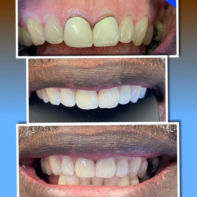 Smile Gallery before and after